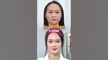 Lộ diện thí sinh trúng vé vàng được tài trợ 100 triệu thẩm mỹ từ A - Z Tại Orchard