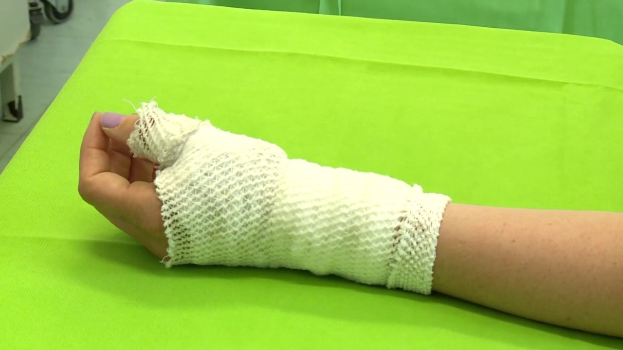 zárt sérülések és ízületek sérülései a kézízületek gyógyulnak