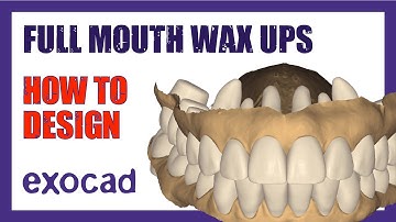 Full Mouth Wax-Up Tutorial | Step-by-Step ExoCAD Design