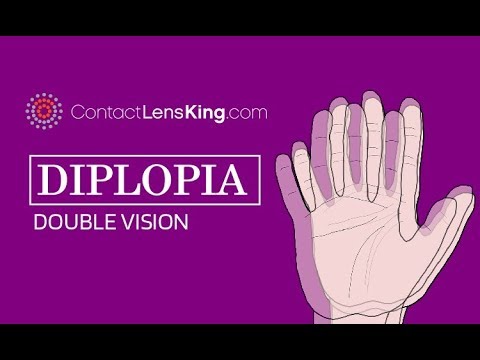 Video: Diplopia: Trattamento, Cause, Varietà