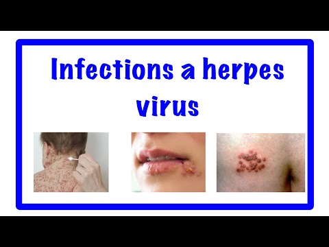 Vidéo: Infection Par L'herpèsvirus Chez Les Oiseaux