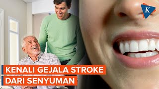 Stroke Bisa Dicegah? Kenali Tanda-tanda dari Senyuman