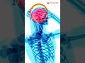 How the Brain Recovers: Neuroplasticity Explained by a Galgotias Student