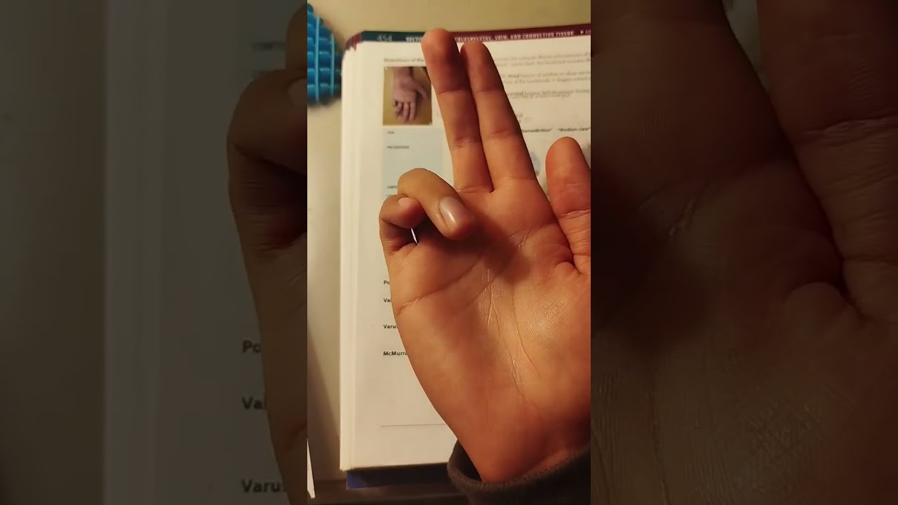 step 1 ulnar claw muscles/nerves dumbed down 