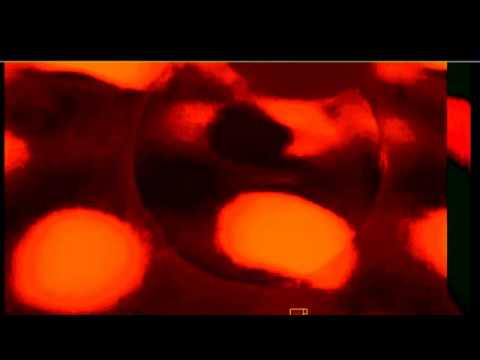 Flat Universe Progressive Circles 2018