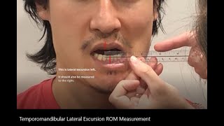 Range of Motion: Temporomandibular (TMJ) Lateral Excursion