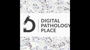 179: How is the BigPicture Project using Foundation Models and AI in Computational Pathology?