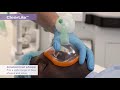 ClearLite™ anesthetic face masks - a clear vision for the future (USA)