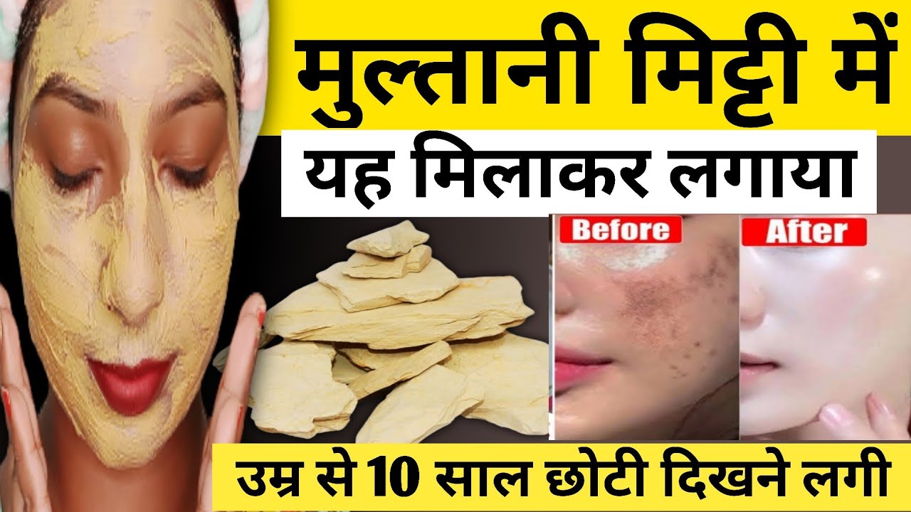 multani mitti face pack | multani mitti face pack for glowing skin ...