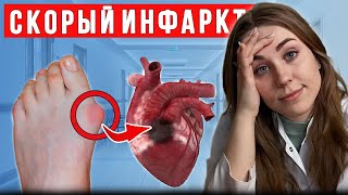 Самые ОПАСНЫЕ признаки скорого инфаркта! Что делать?