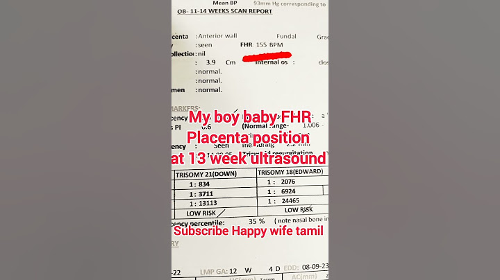Boy Baby 👦 NT scan Full Report|Importance of NT scan report and explanation of complete Scan report