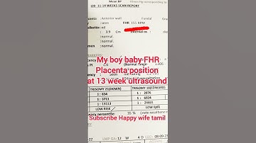 Boy Baby 👦 NT scan Full Report|Importance of NT scan report and explanation of complete Scan report