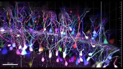 Mitral cells