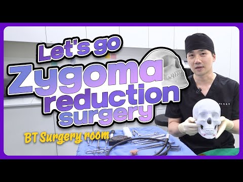 Zygoma Reduction Surgery