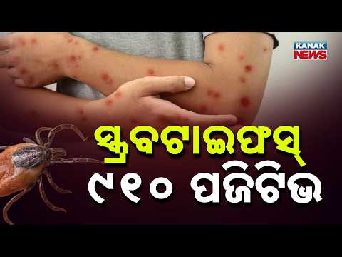 ସ୍କ୍ରବ୍‌ଟାଇଫସ୍‌ ଚିନ୍ତା | Sundargarh Scrub Typhus Cases | 910 Positive Reports Under Review