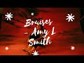 Lewis Capaldi - Bruises - Short Cover || Amy L Smith