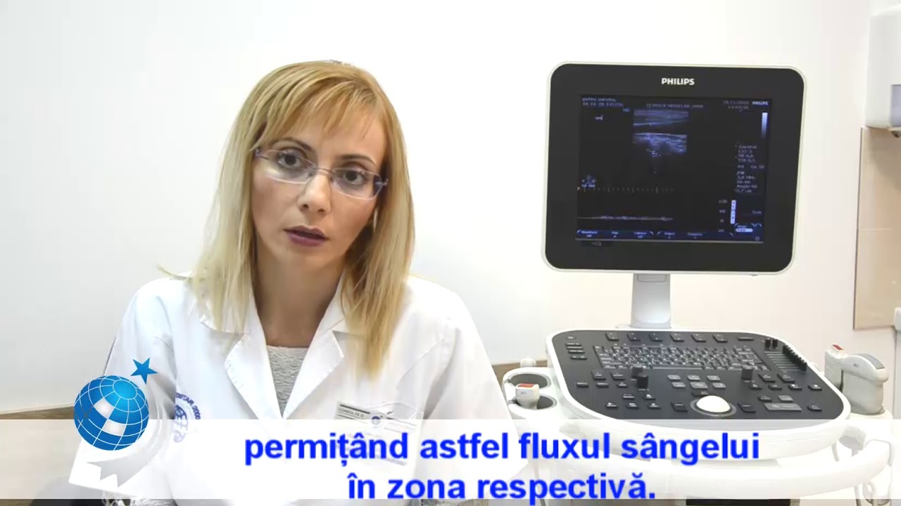 Ecografia Doppler carotido-vertebrala | Dr Alina Jdirea