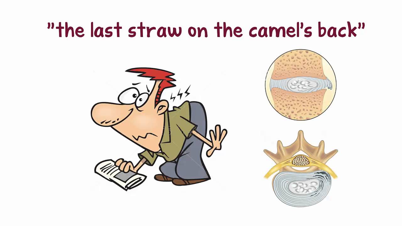 How To Treat Your Low Back Pain And Sciatica By Dr Mike Hsu Youtube