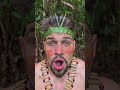 “A Tribal Man Healed a Foreigner’s Red Eye With a Jungle Herb 😱🌿”