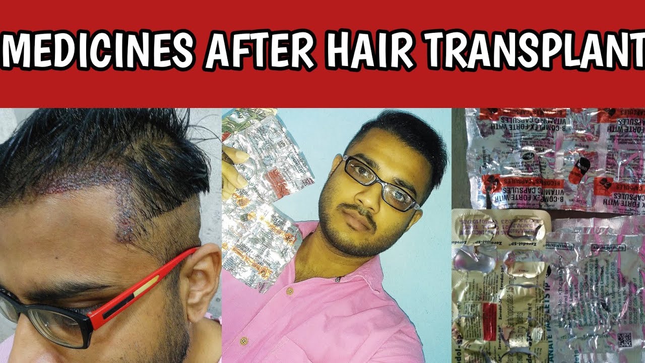 Hair transplant and medicines | Hair heal talks.