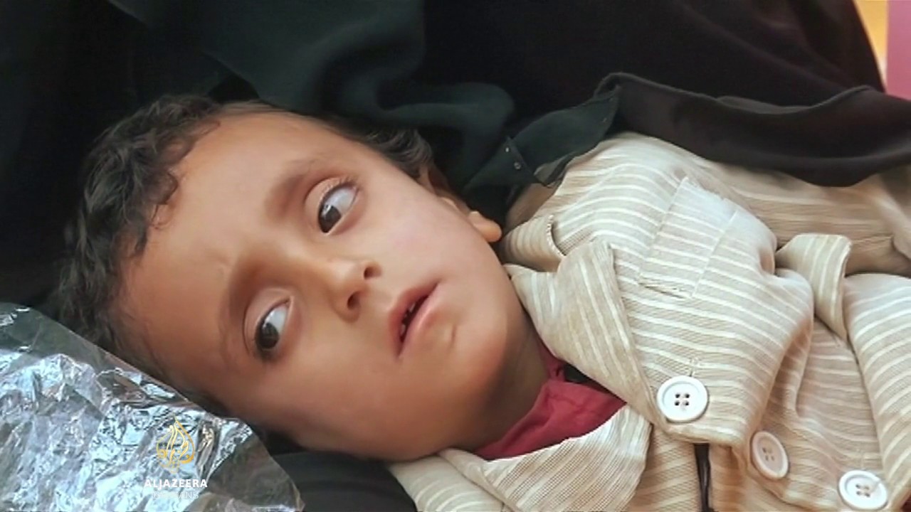 توفي أكثر من 1200 شخص بسبب الكوليرا في اليمن
