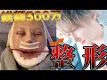 【韓国整形】総額300万円!?ダウンタイム中の現役ホストがありのままを告白!!!【本音】