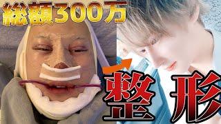 【韓国整形】総額300万円!?ダウンタイム中の現役ホストがありのままを告白!!!【本音】