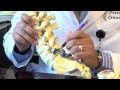 Surgical Procedures - Lumbar Laminectomy & Discectomy