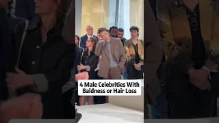 Famous 4 male celebrities with baldness or hair loss #actors #celebrities #hollywood#celebrity Net Worth