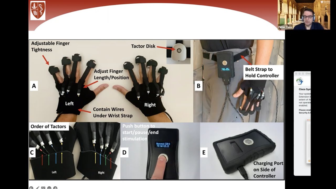 A Glove To Treat Parkinson’s Disease? YouTube