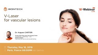 [10th W-Webinar] V-Laser  for vascular lesions_ Dr Cartier