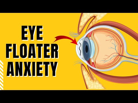 How to stop worrying about floaters in eyes
