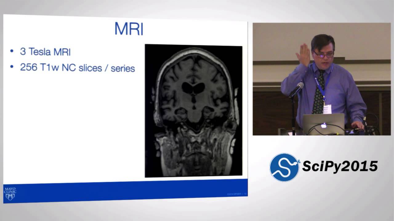 Python Derived Imaging Biomarkers of Dementia | SciPy 2015 | Ross Mitchell