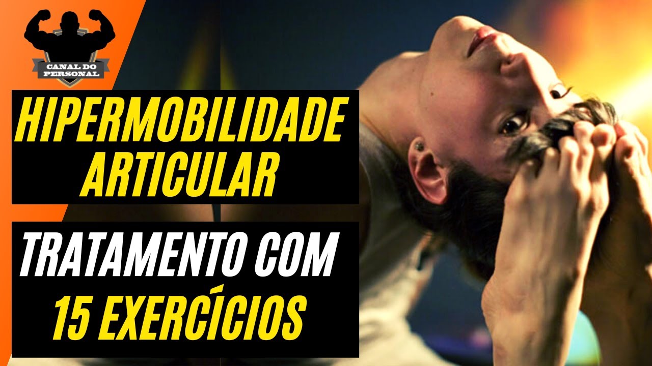 Hipermobilidade Articular 15 Exercícios de Musculação - YouTube