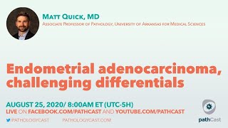 Endometrial adenocarcinoma, challenging differentials  Dr. Quick (UAMS) #GYNPATH