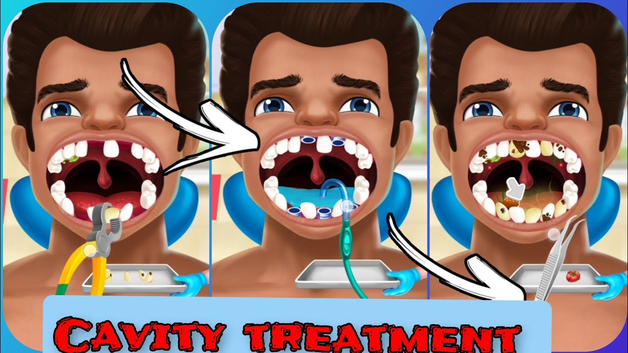 Cavity treatment/Tooth cleaning ASMR/Animation tooth cleaning