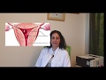 Endometrial polip nedir - Endometrial polip tedavisi