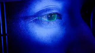 Beyond the Symptoms | How Optometrists Diagnose Dry Eye Disease | Meibography