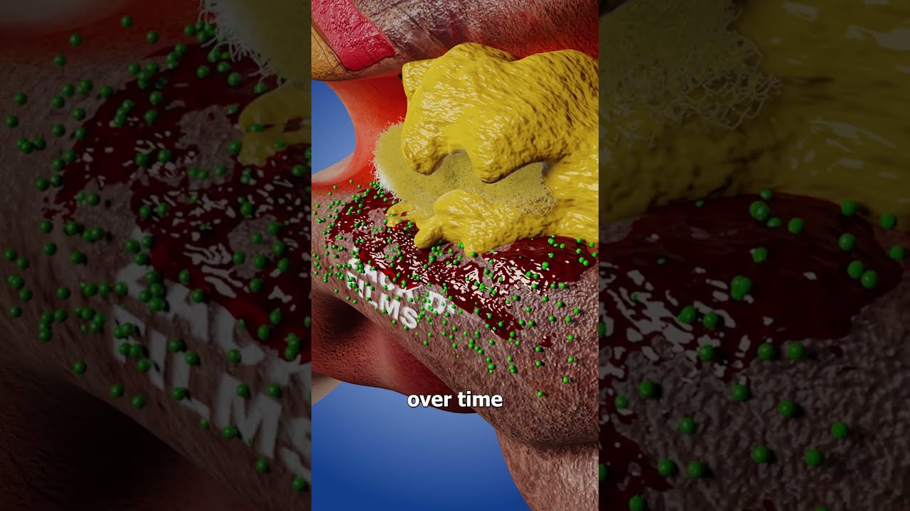 Cotton Swab Gets Stuck In Your Ear 