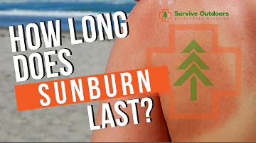 Jak dlouho se sluneční popáleniny ta ke hojí?