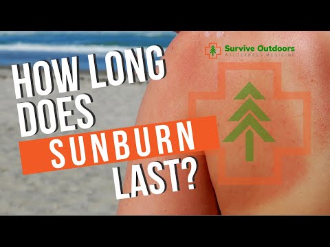 Video: Ako dlho trvá spálenie od slnka?