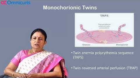 Multiple Pregnancy: Management Made Easy