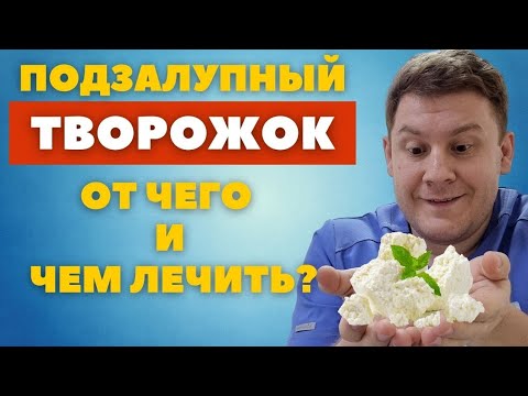 Подзалупный творожок // Как не потерять орган// Смегма и баланопостит //