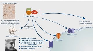 Alzheimer's Disease: APP Processing & Amyloid Plaque Formation