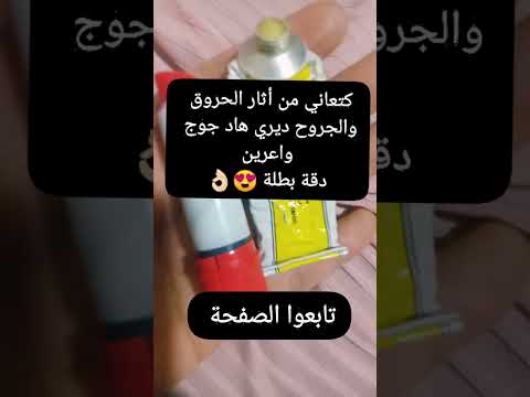 كتعاني من أثار الحروق والجروح ديري هاد جوج واعرين وكيعطيو نتيجة مضمونة ابلور لايك 