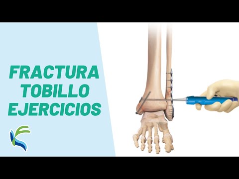 Video: Cómo Ejercitar Una Pierna Con Una Fractura De Tobillo