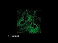 Митофагия в нейронах в норме и после добавления экзогенного HSP-70 (конфокальная микроскопия)