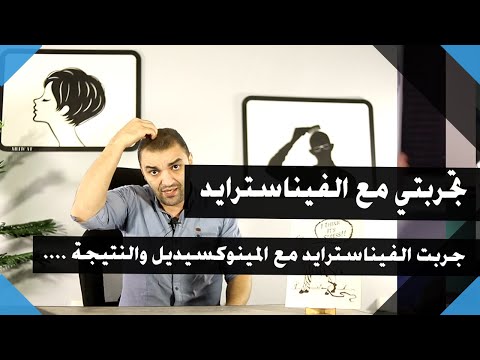تجربتي في استخدام الفيناسترايد لعلاج الصلع الفيناسترايد مع المينوكسيديل
