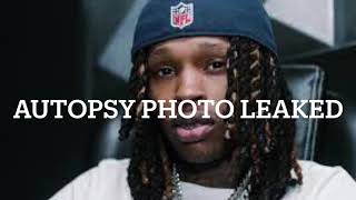 Atlanta send message to all outsiders with the leaking of King Vons autopsy photo. So disrespectful