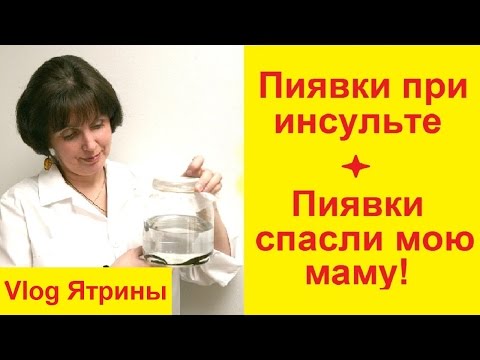 Пиявки при инсульте. Отзывы